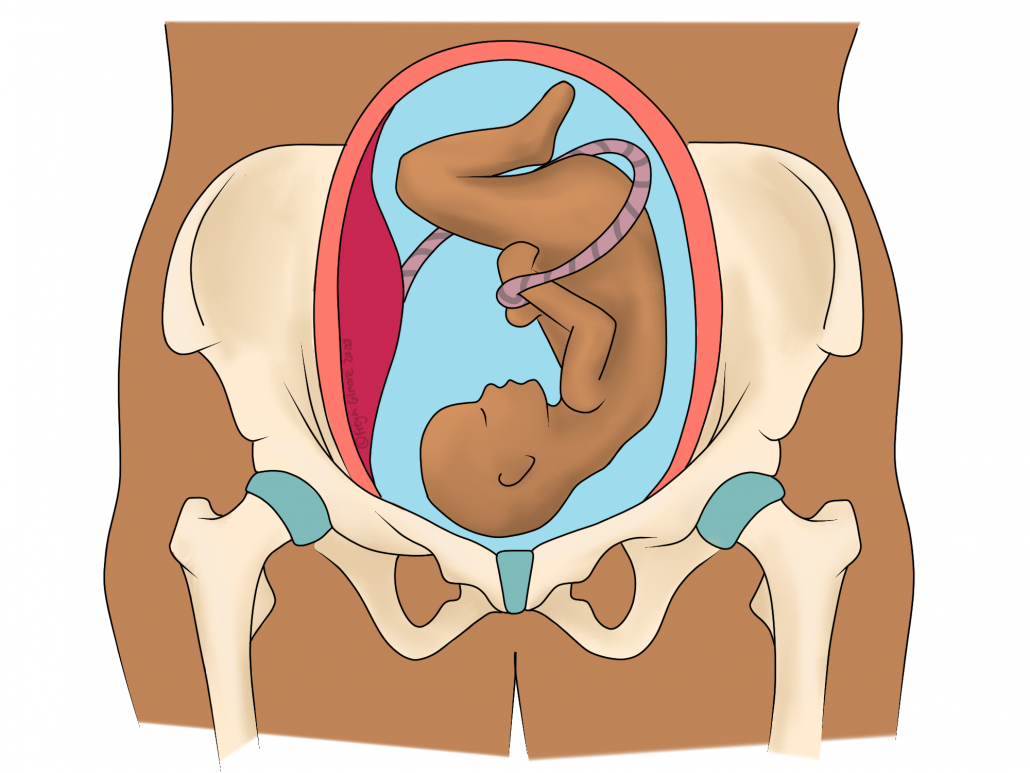 The pelvis in pregnancy