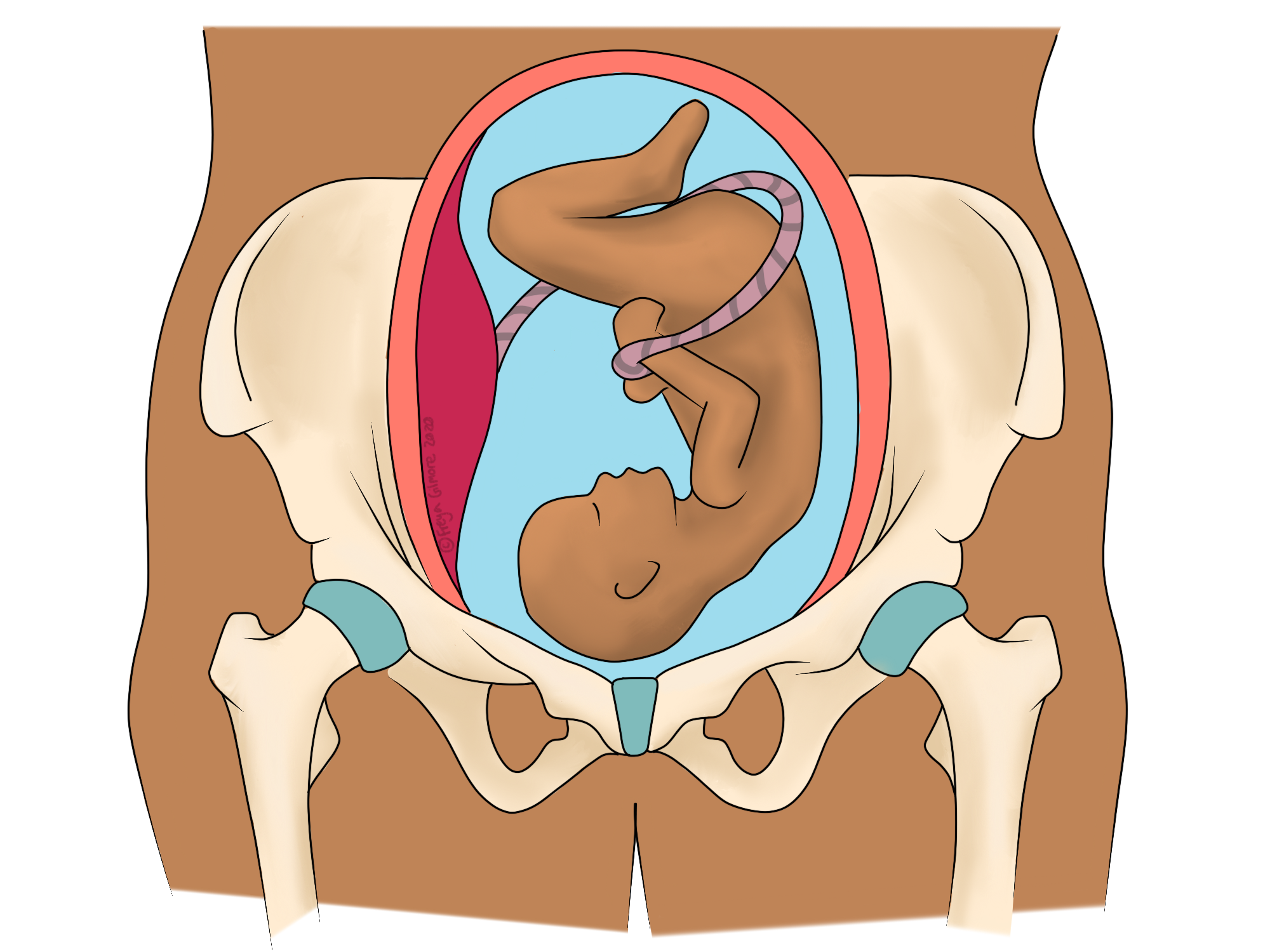Symphysis Pubis Dysfunction During Pregnancy - Yes Mama Co.