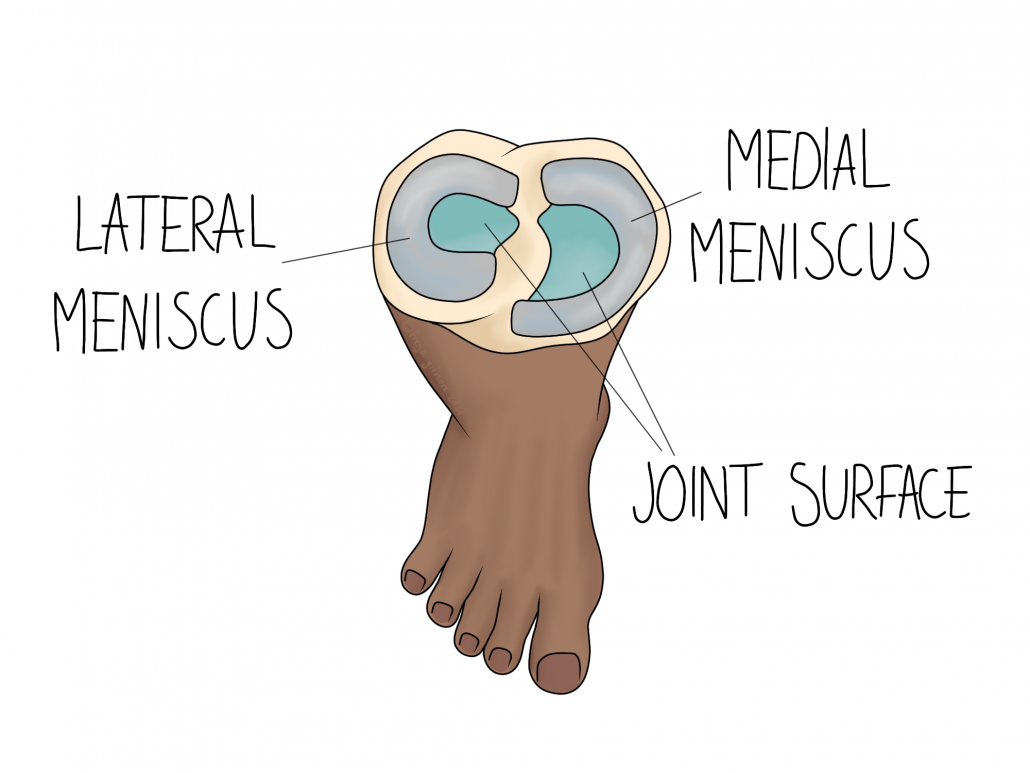 Sports injuries: meniscus tears