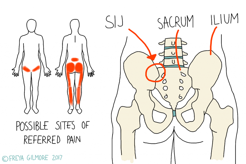 sacroiliac Joint Pain